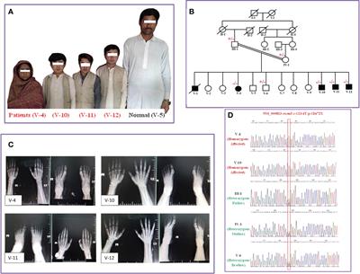 A GHRHR founder mutation causes isolated growth hormone deficiency type IV in a consanguineous Pakistani family